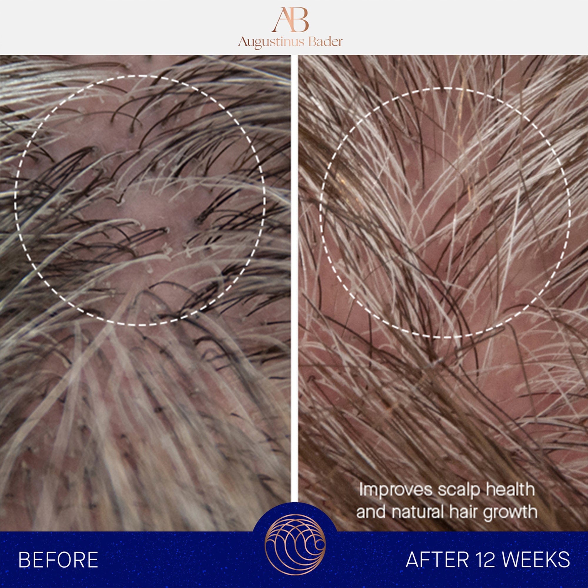 The Conditioner Augustinus Bader Acondicionador - ABANUC