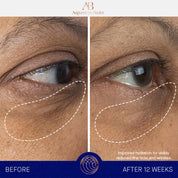 The Eye Cream Augustinus Bader Contorno de ojos - ABANUC