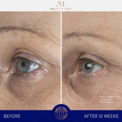 The Eye Cream Augustinus Bader Contorno de ojos - ABANUC