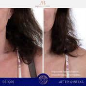 The Leave-In Hair Treatment Augustinus Bader Acondicionador en seco - ABANUC