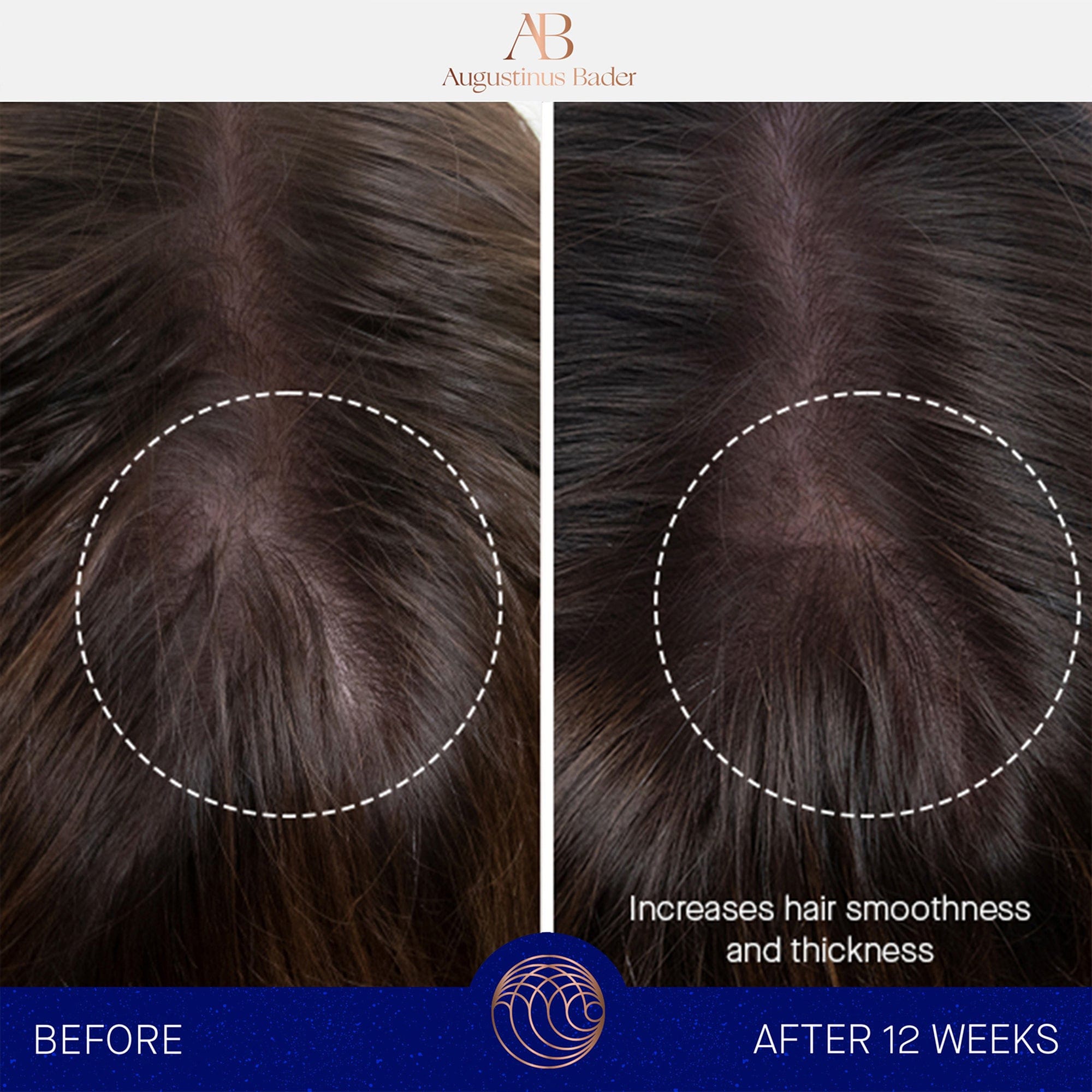 The Leave-In Hair Treatment Augustinus Bader Acondicionador en seco - ABANUC