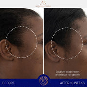 The Scalp Treatment Augustinus Bader Suero capilar - ABANUC