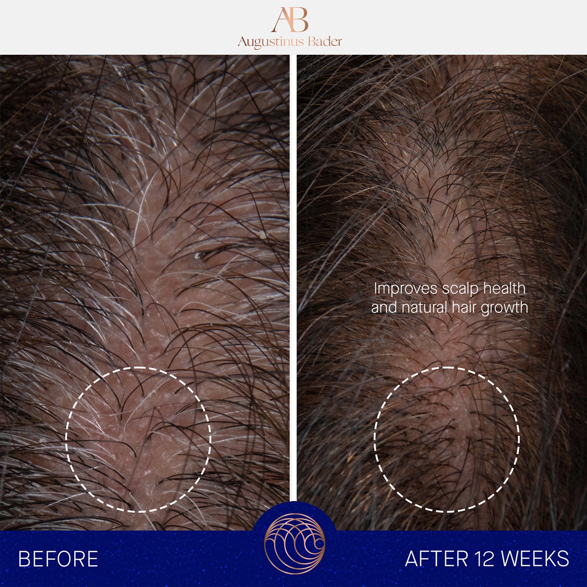 The Scalp Treatment Augustinus Bader Suero capilar - ABANUC