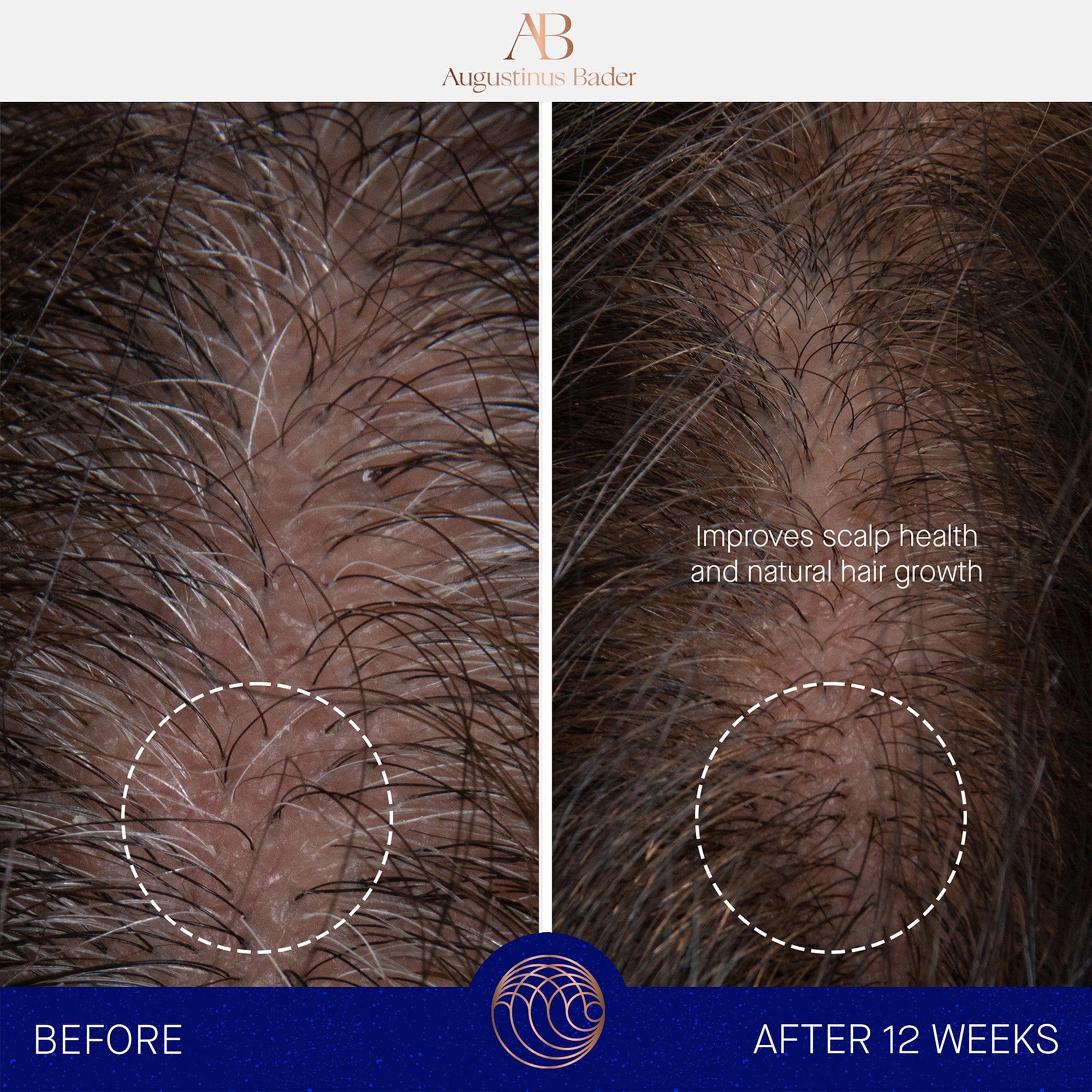 The Scalp Treatment Augustinus Bader Suero capilar