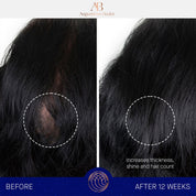 The Scalp Treatment Augustinus Bader Suero capilar - ABANUC