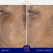 The Serum Augustinus Bader Sérum facial - ABANUC