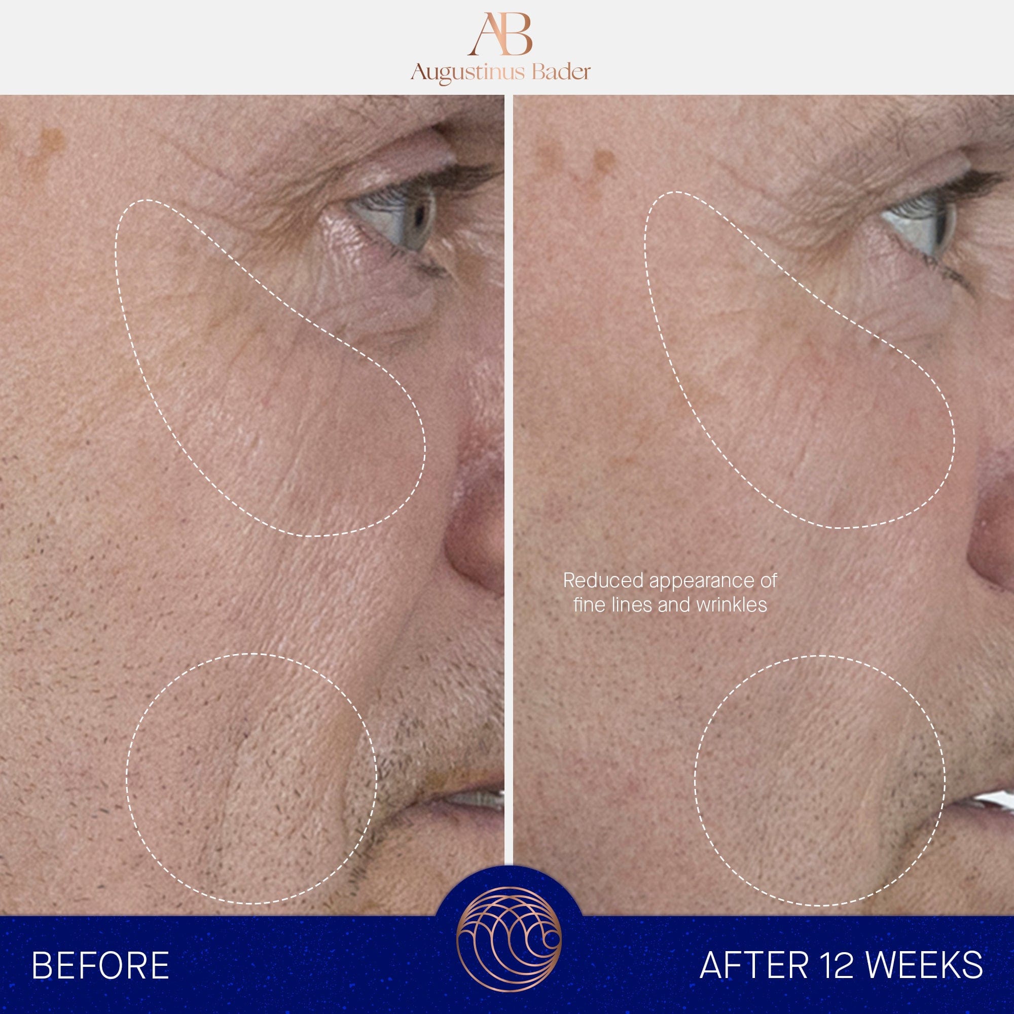 The Serum Augustinus Bader Sérum facial - ABANUC