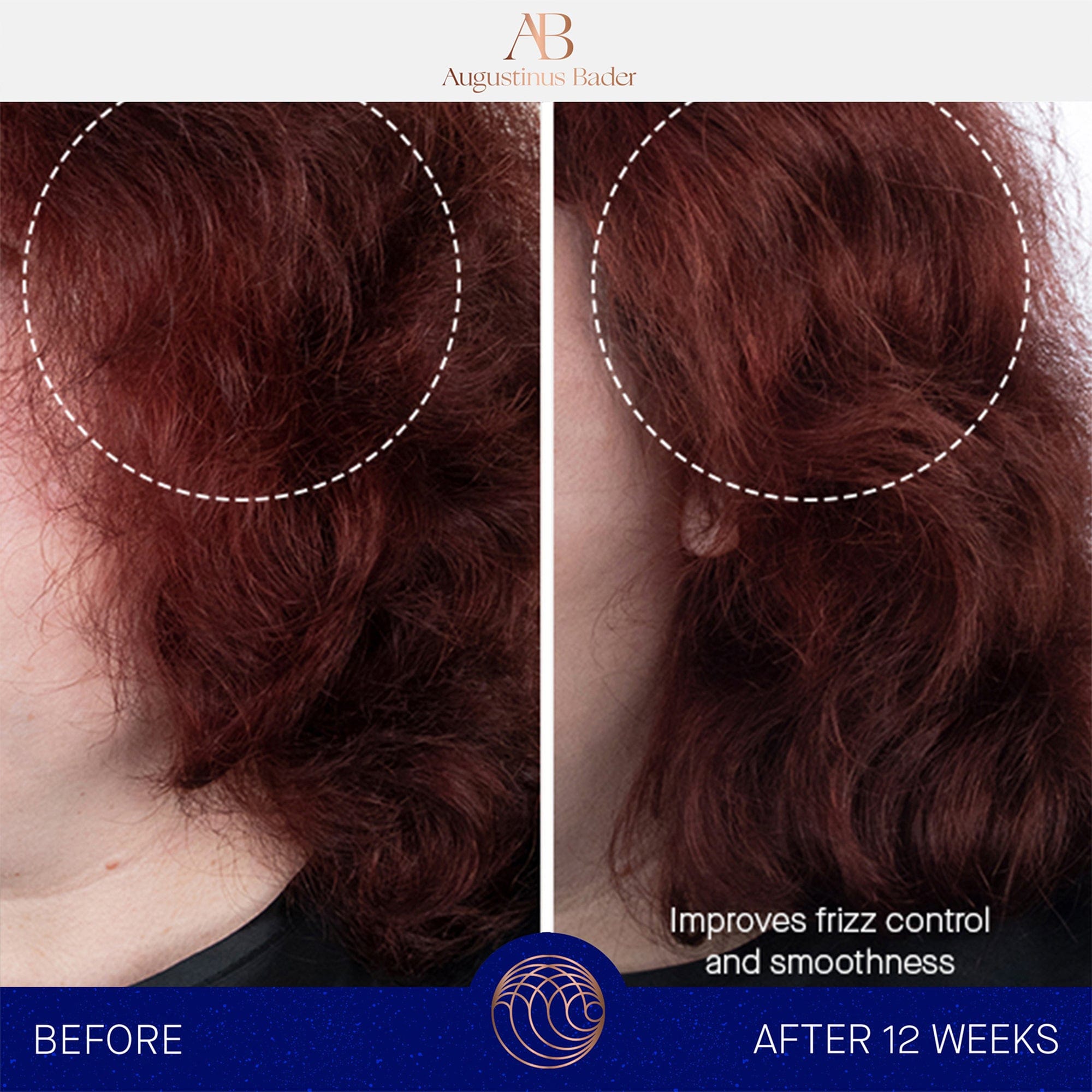 The Shampoo Augustinus Bader Champú - ABANUC
