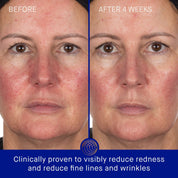 The Hydrogel Face Mask Augustinus Bader Mascarilla facial de hidrogel