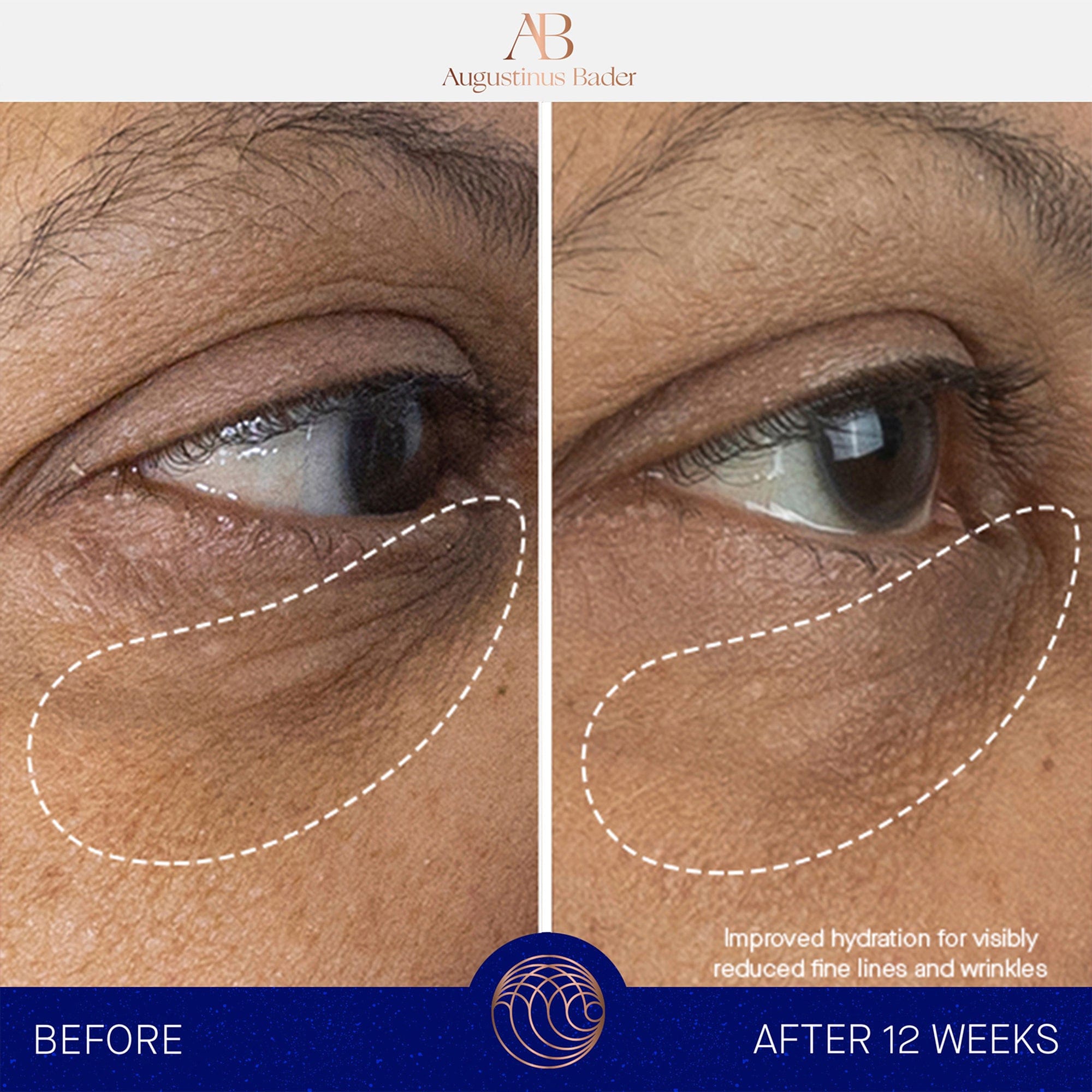 The Eye Cream Augustinus Bader Contorno de ojos - ABANUC