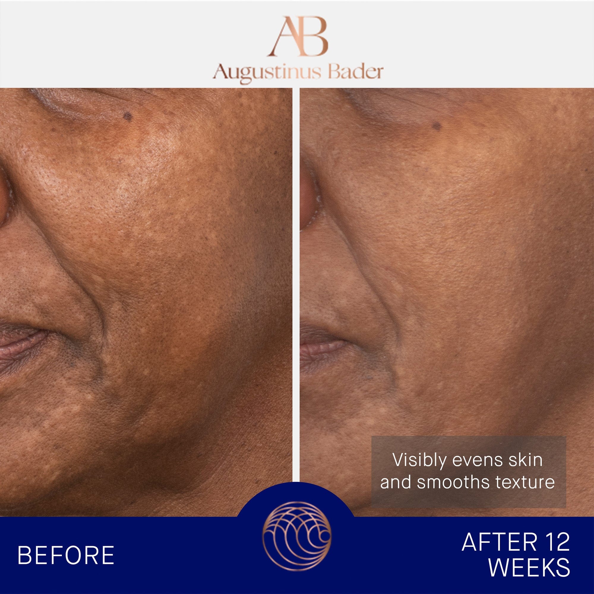 The Face Cream Mask Augustinus Bader Mascarilla hidratante - ABANUC