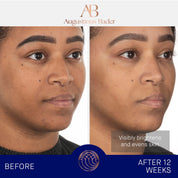 The Face Cream Mask Augustinus Bader Mascarilla hidratante - ABANUC