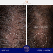 The Scalp Treatment Augustinus Bader Suero capilar - ABANUC